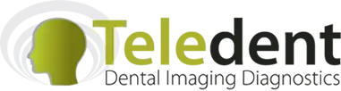 Teledent Logo