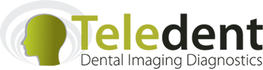 Teledent Logo