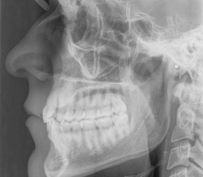 Lateral cephalograms report